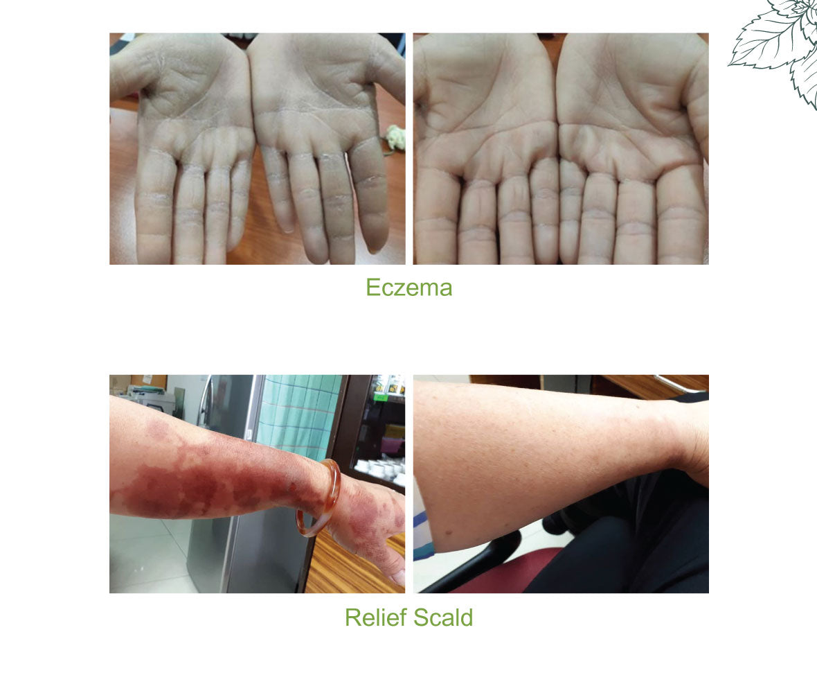 TruHerbs Galesie Cream